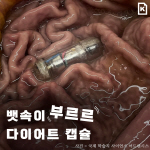 [카드뉴스]뱃속이 부르르…1000원 짜리 다이어트 캡슐