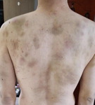 �������� 2�Ⱓ ��Ÿ�����ڡ� �߽Ĵ� ���� �¸� �������̿���